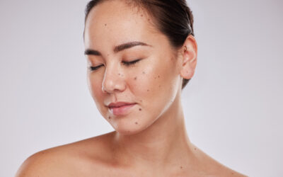 Can Scarless Mole Removal Treat Raised or Flat Moles?
